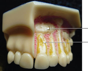 Model of developing teeth in a 3 year old child
