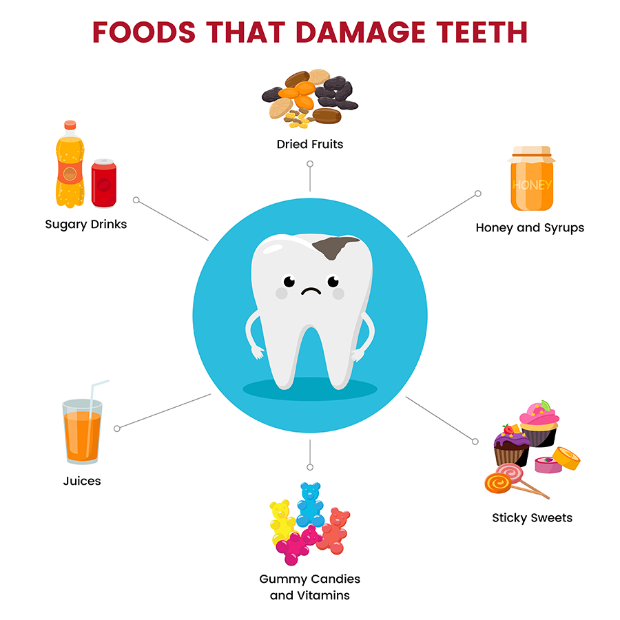 Foods that Damage Teeth