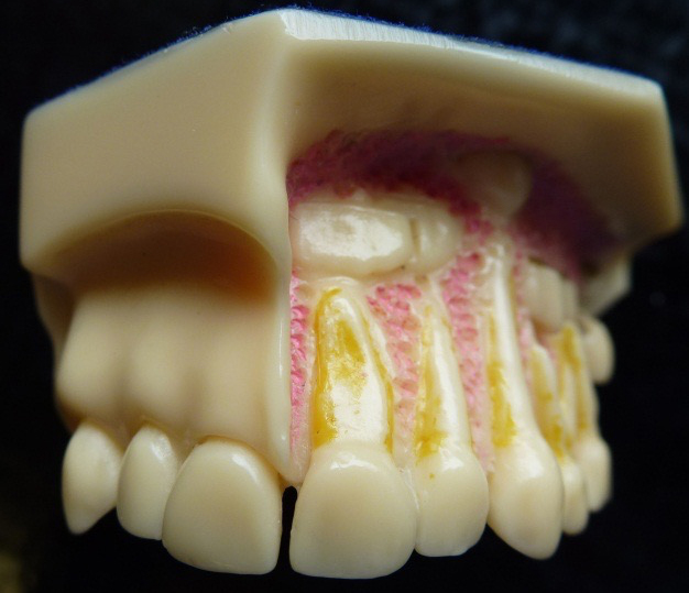 Model of developing teeth in a 3 year old child
